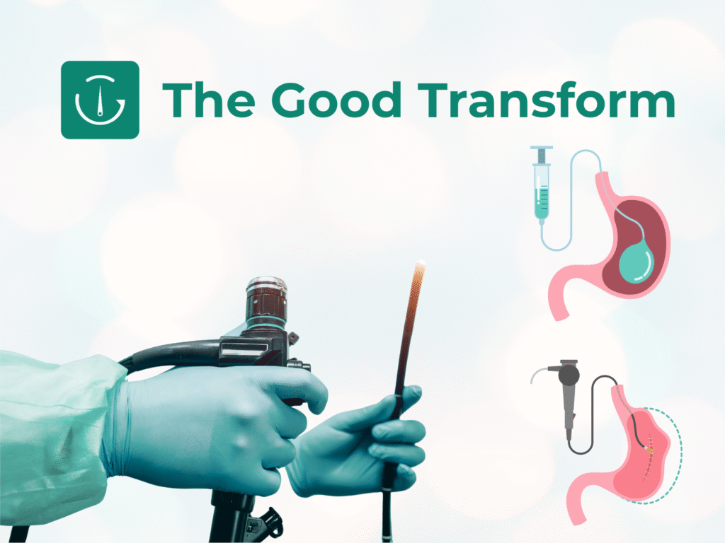 endoscopic-sleeve-gastroplasty-esg